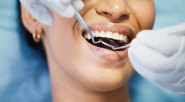 Best Dentist for Tooth Abscess  in Las Cruces, NM
