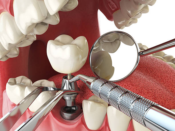 Emergency Gum Pain Relief in NM